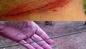 Heridas y cables similares a los aparecidos en Sanabria