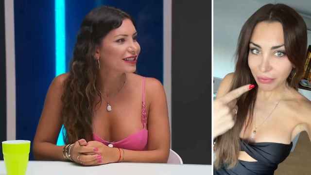La influencer Daniela Requena antes y después de someterse a la queratopigmentación.
