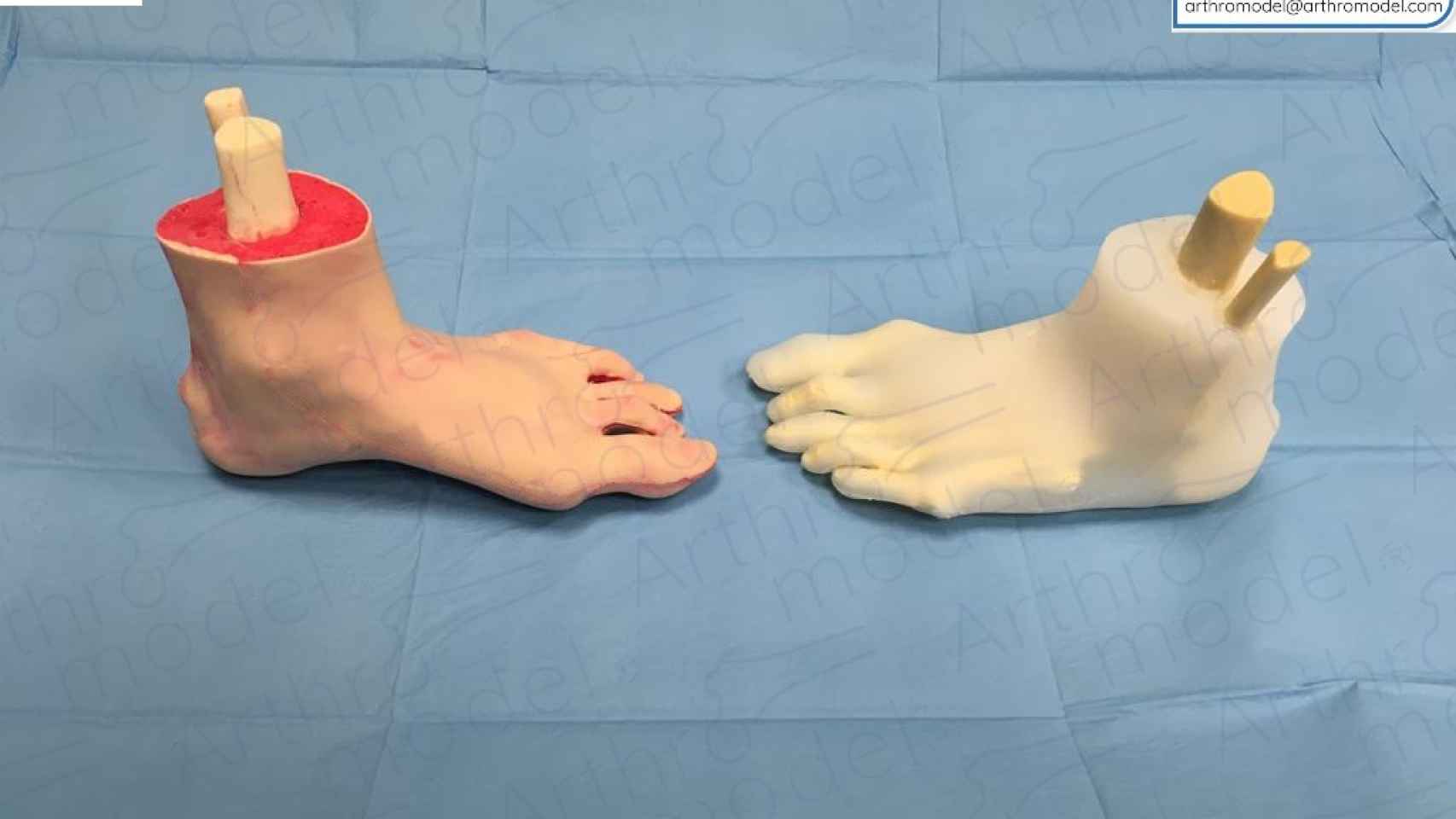 Los biomodelos de pies que incluyen un tobillo fracturado son uno de los pedidos más recurrentes que recibe esta compañía, por parte de traumatólogos.
