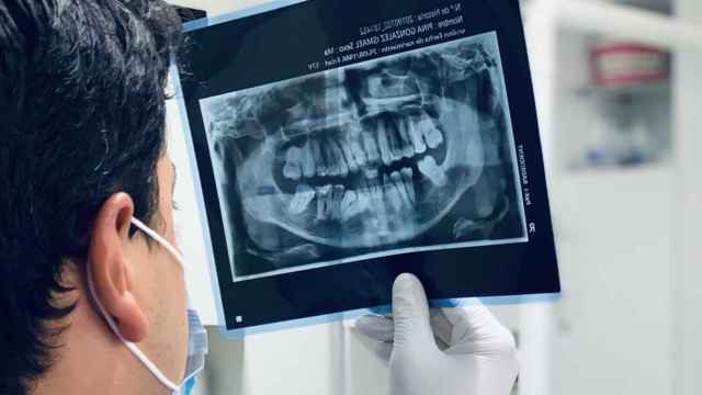 Radiografía de la dentadura.