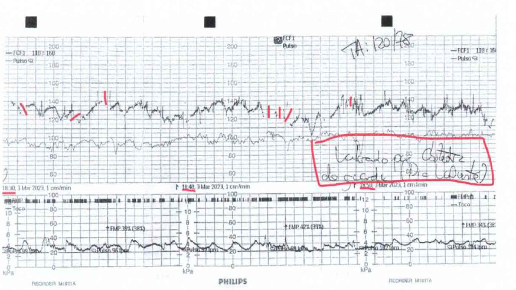 Una captura de las gráficas de monitorización fetal, con anotaciones manuscritas por personal sanitario, donde se refleja que han consultado con la ginecóloga supuestas ausencias de latidos en el corazón de la bebé que esperaba Ana.