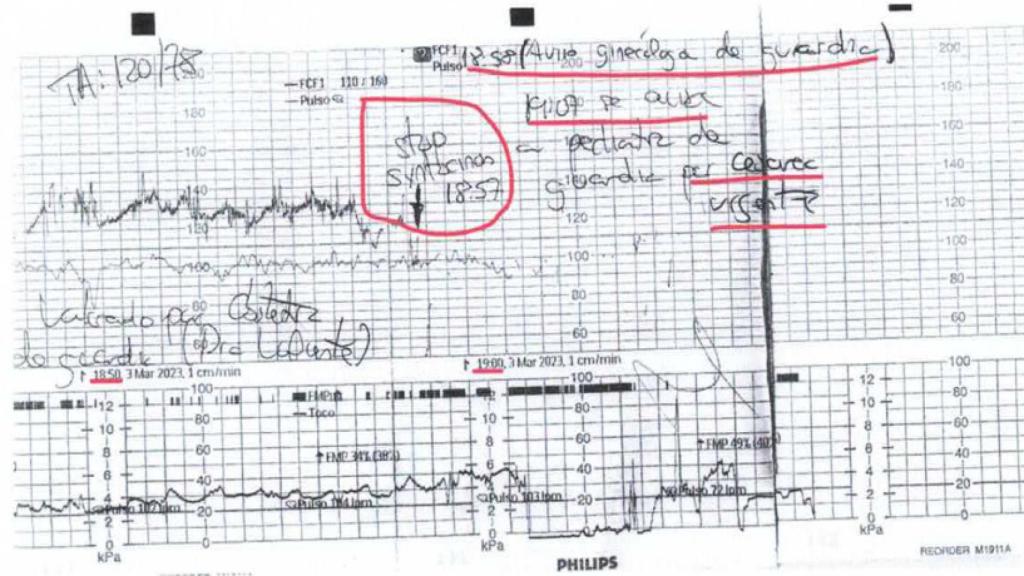 Numerosas anotaciones del personal médico en una de las gráficas de monitorización fetal, cuyos datos alertaban supuestamente de que había complicaciones en el parto de Ana.
