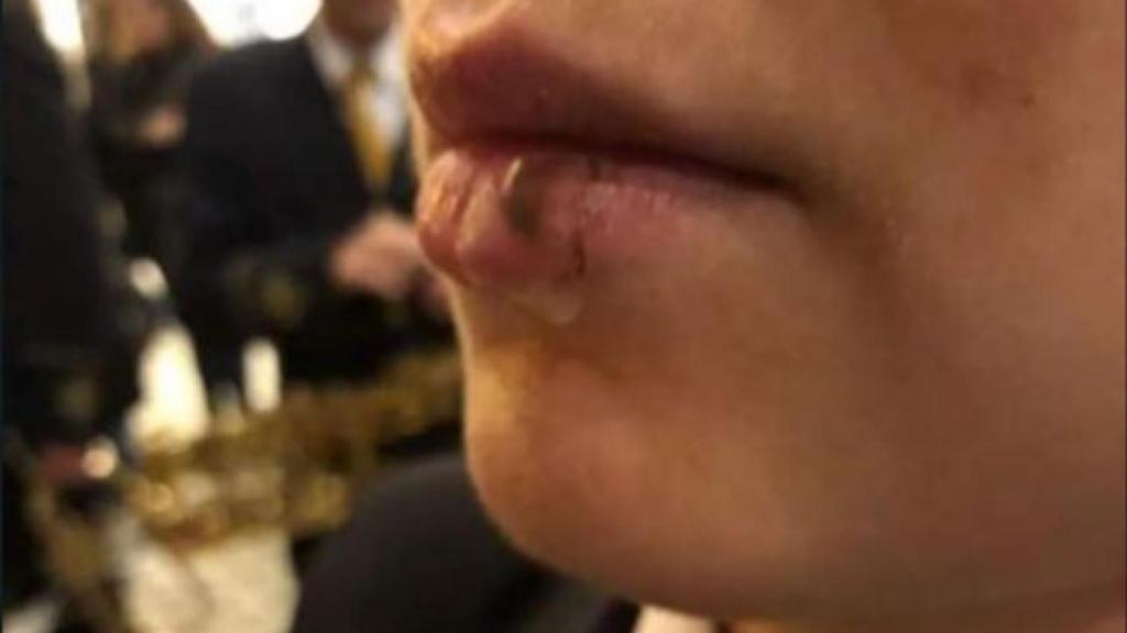 Daños físicos por cruzarse en la banda de música