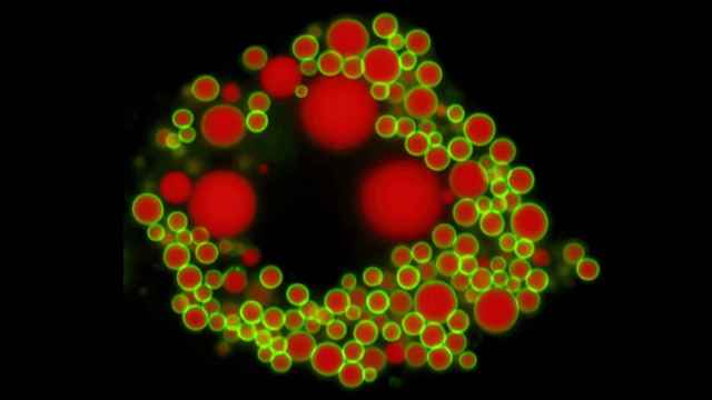 Gotas de grasa en células de sangre. © Johanna Spandl / University of Bonn
