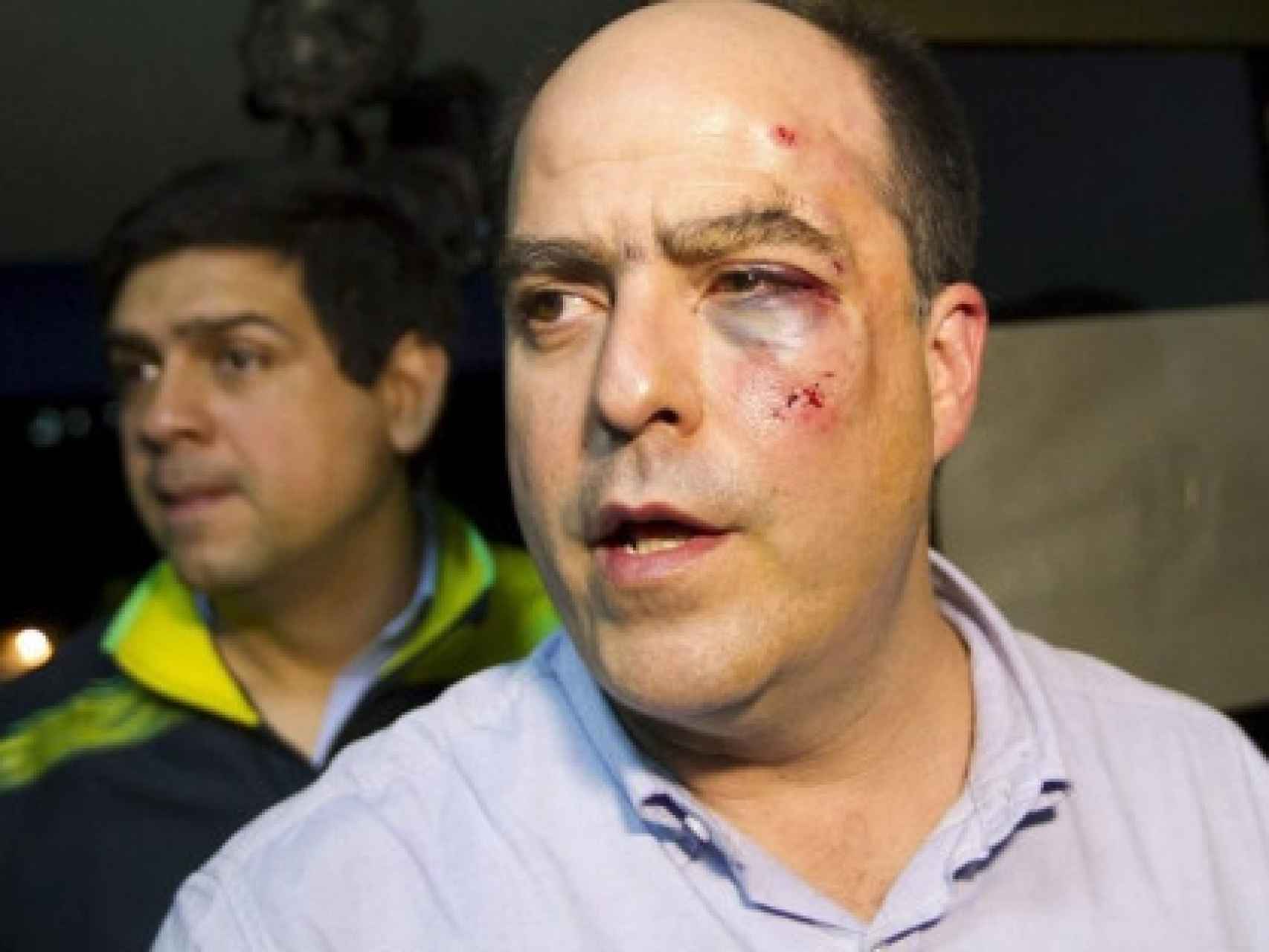 El opositor Julio Borges, tras ser golpeado por los diputados chavistas en 2013.
