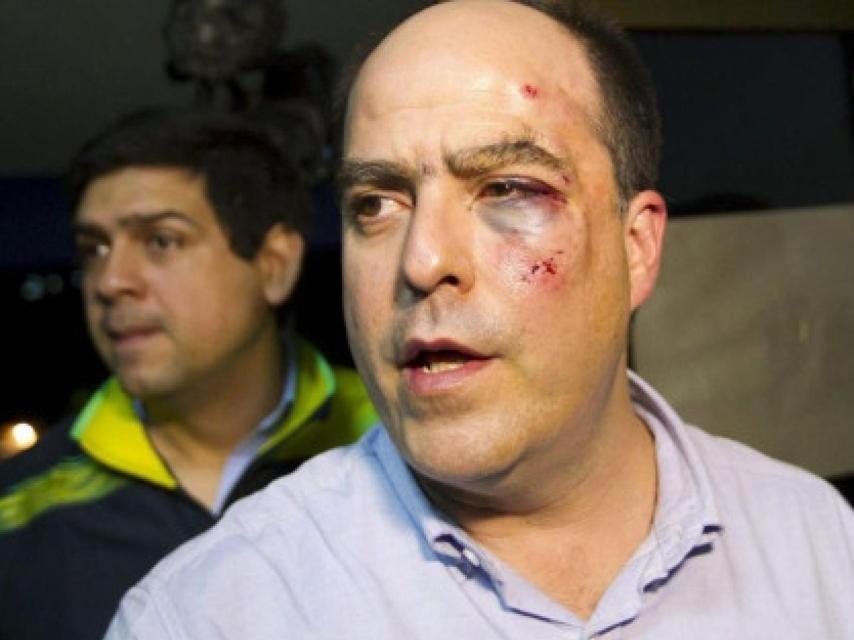 El opositor Julio Borges, tras ser golpeado por los diputados chavistas en 2013.