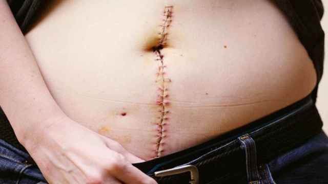 Imagen de una campaña para visibilizar el dolor de la endometriosis.