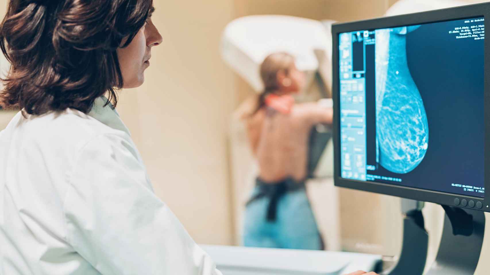 Médico realizando una mamografía