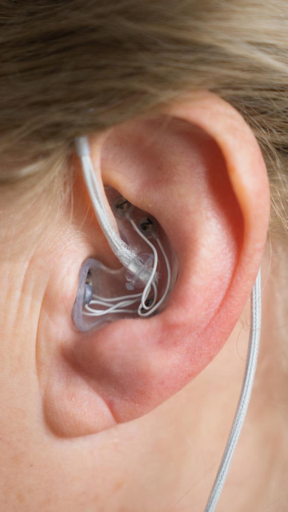 El dispositivo en una oreja de un paciente.