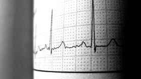 Imagen de un electrocardiograma