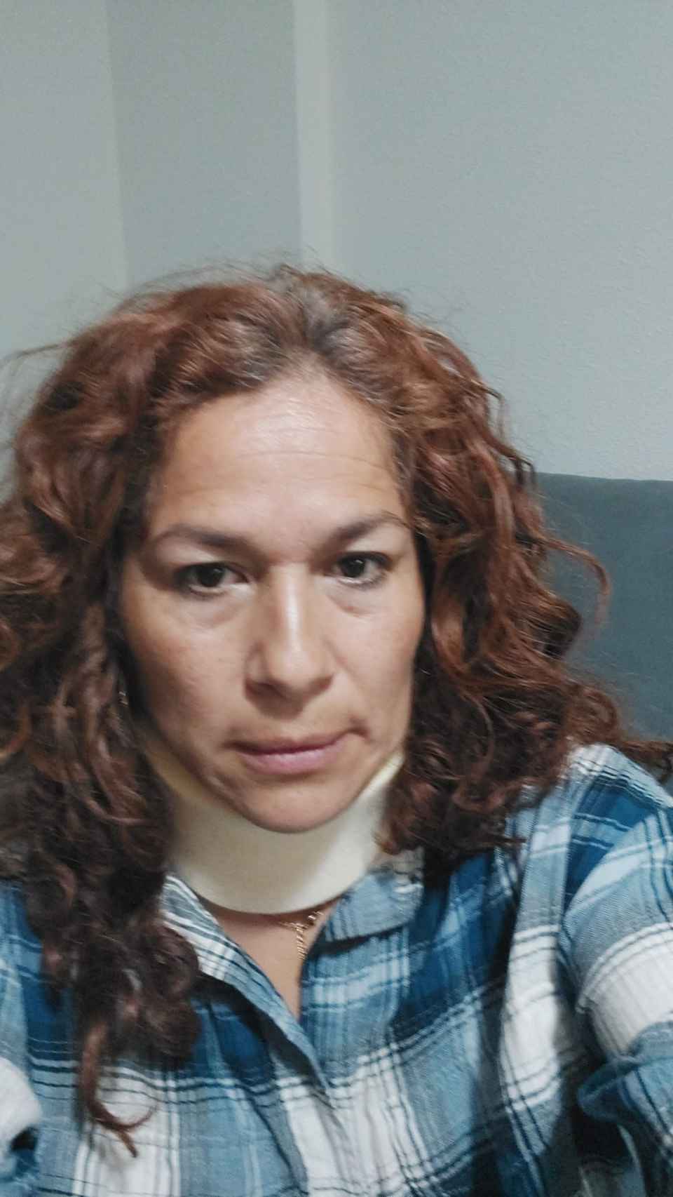 La peruana Sara Ramírez, en su casa, con un collarín tras acudir a urgencias.