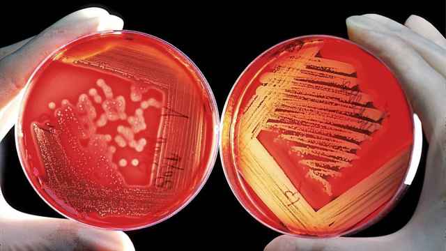 Dos placas de Petri con cultivos bacterianos.