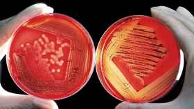 Dos placas de Petri con cultivos bacterianos.