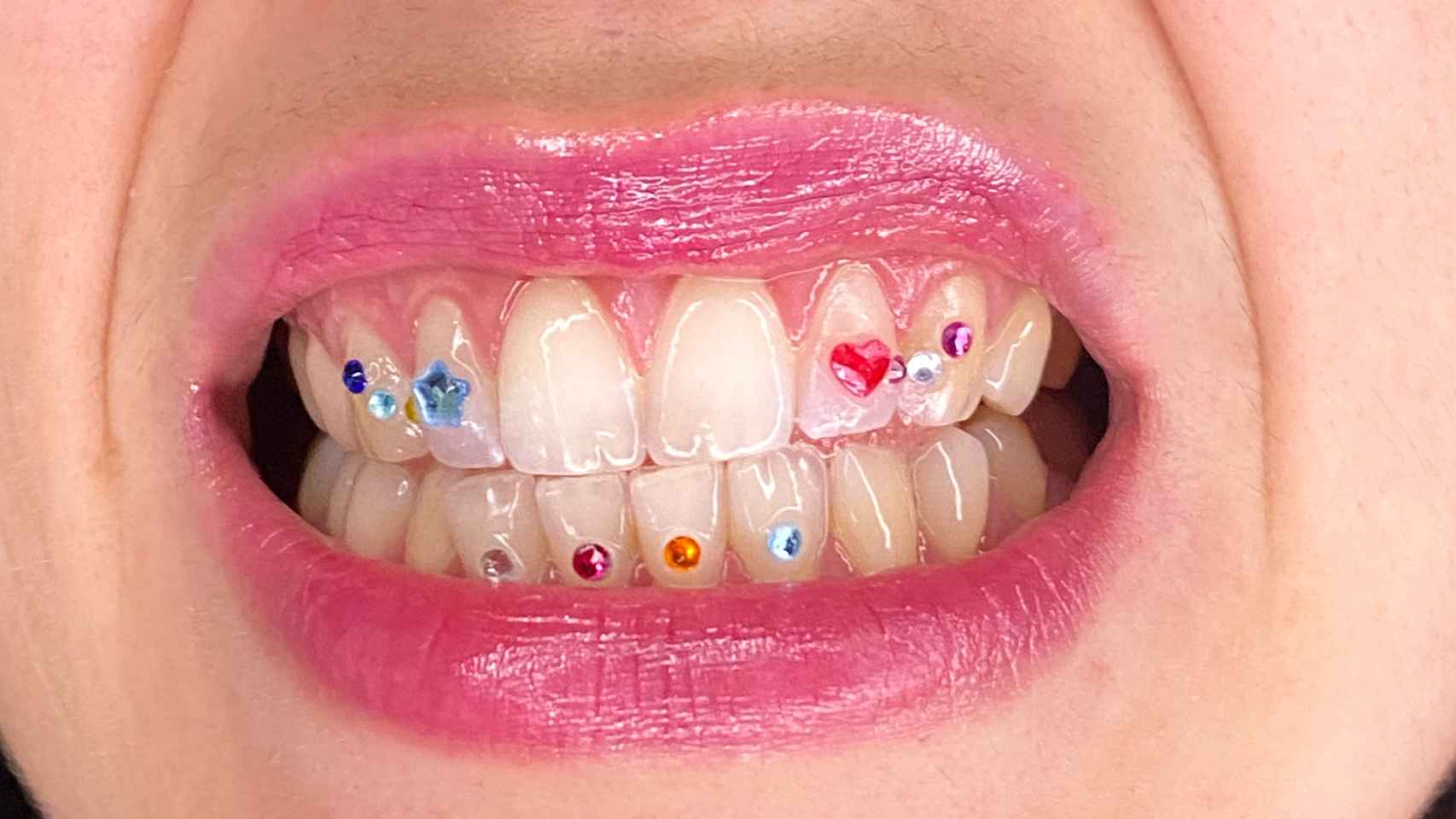 Diseño de gemas en los dientes por @valiumgem