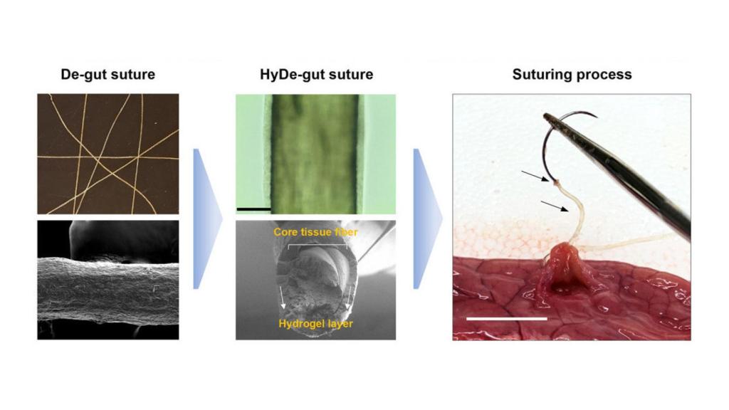 Composición del nuevo tejido de sutura inteligente