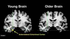 Escáneres cerebrales para determinar el rejuvenecimiento del cerebro,