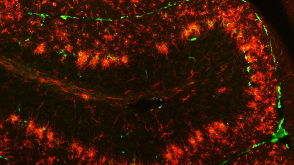 Inmuno fluorescencia microglía en el cerebelo del ratón PCD tratado con OEA