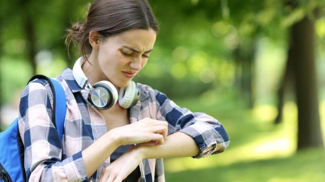 Una mujer con picadura de mosquito.