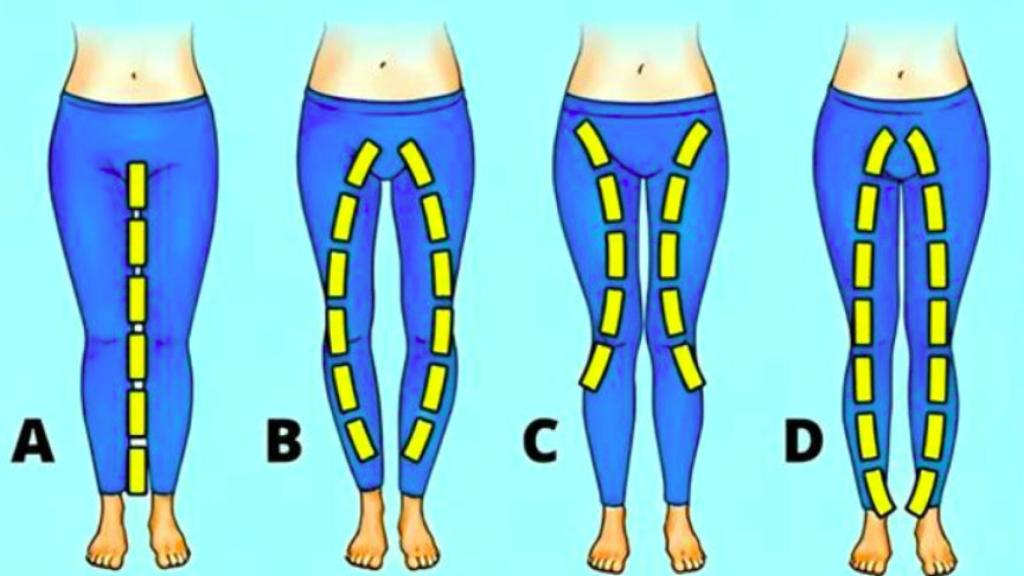 ¿Cómo son tus piernas?