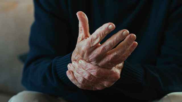 Unas manos con artrosis.