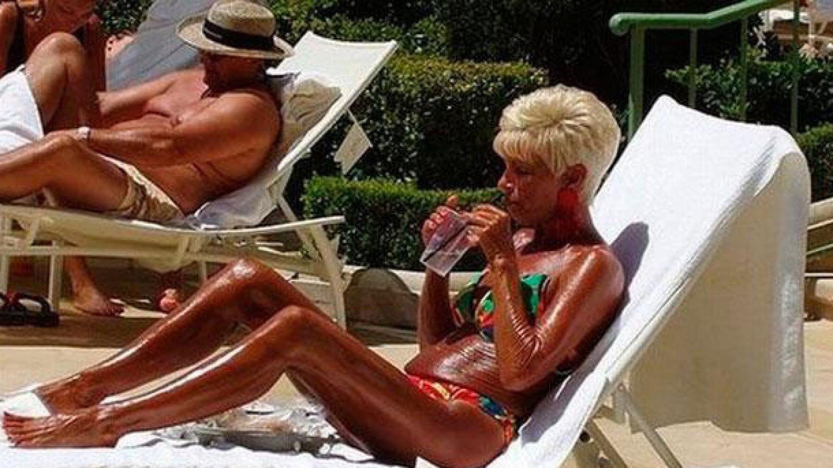 Una mujer muy bronceada se expone al sol.