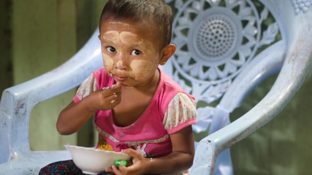 Un niño en Myanmar al que atiende World Vision.