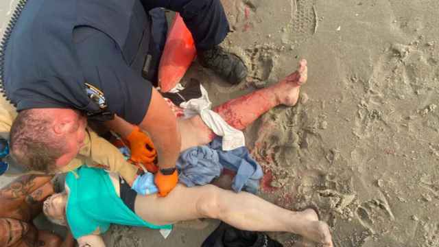 Tatyana Toltunyuk, la mujer atacada por un tiburón en una playa de Nueva York