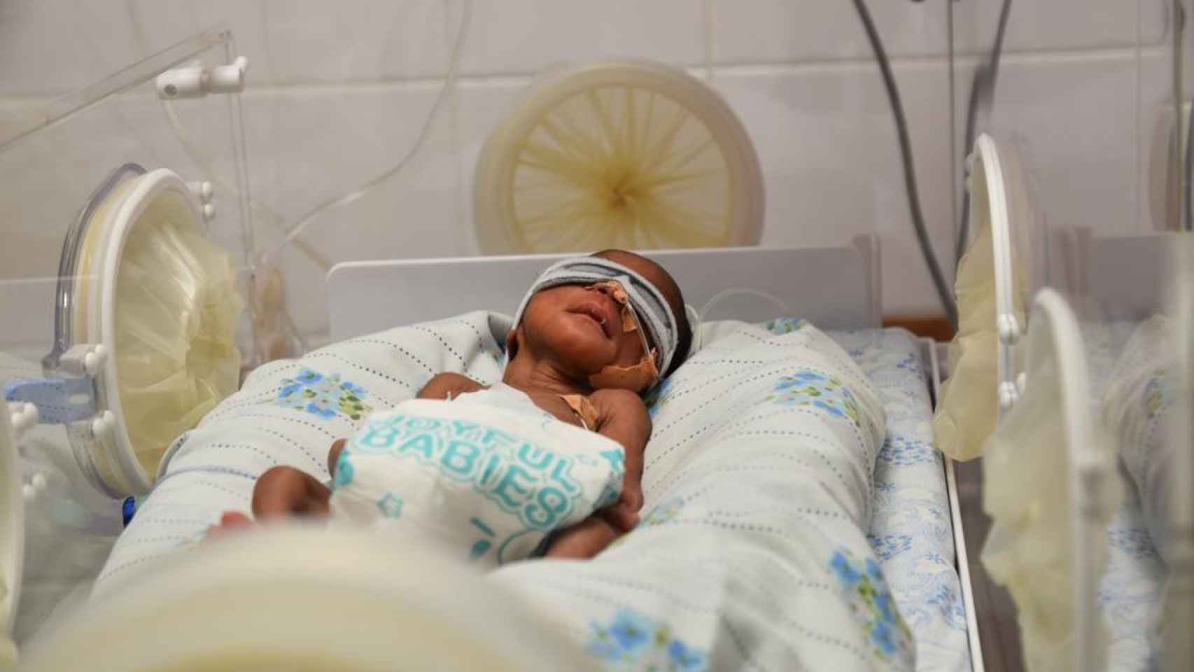 Imagen de archivo de un recién nacido en la incubadora.