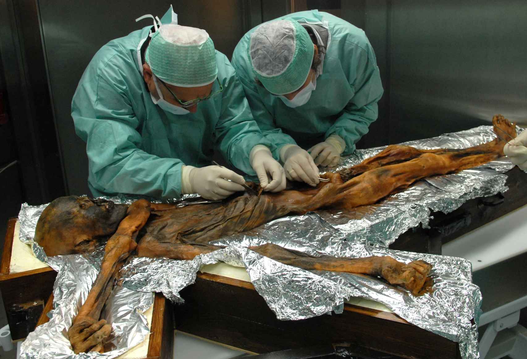 Científicos analizando el cadáver de Ötzi. South Tyrol Museum of Archaeology/Eurac/Marco Samadelli-Gregor Staschitz