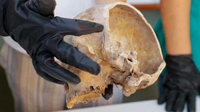 El cráneo 952 del Museo Canario.
