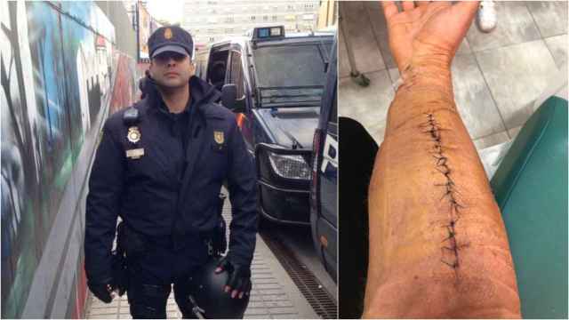 Ángel uniformado de Policía Nacional y la herida en su brazo.