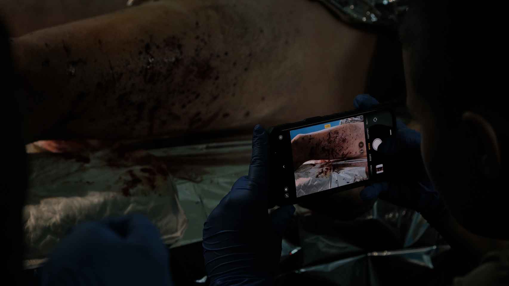 Una médica ucraniana del frente de Bakhmut documenta las heridas de Ruben Mawick a su llegada al punto de estabilización