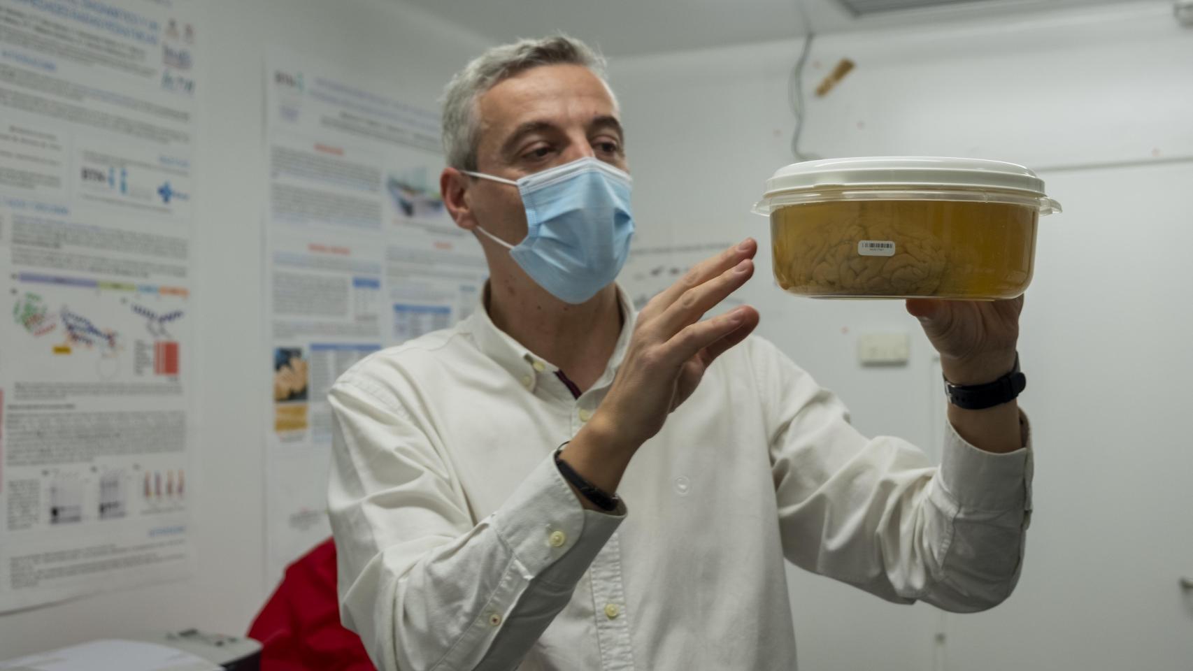 El doctor Javier Herrero, director del banco de cerebros en Salamanca