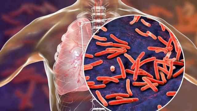 El cáncer de pulmón, último objetivo de la centenaria vacuna contra la tuberculosis