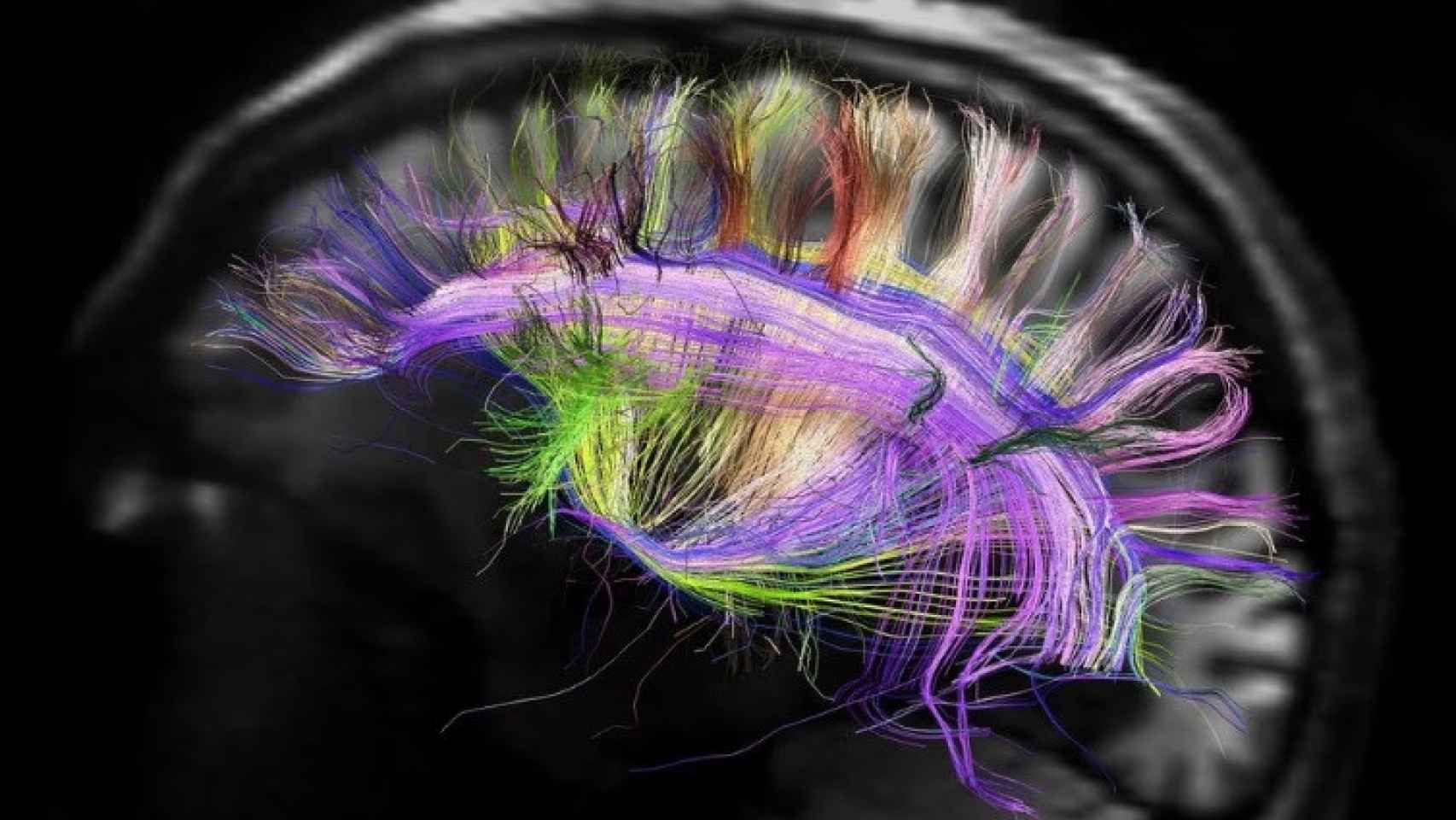 Imagen de una resonancia magnética del cerebro humano.