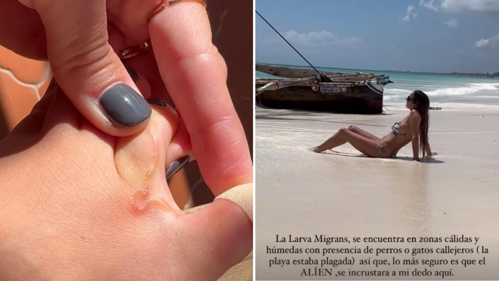 Primer plano de la larva y la playa en la que la 'influencer' cree que la infectó. @luciapombo