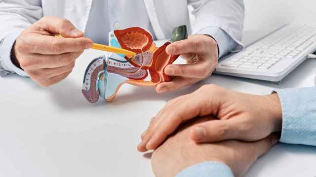 Modelo del sistema reproductor masculino en las manos de un médico durante la consulta de un paciente.