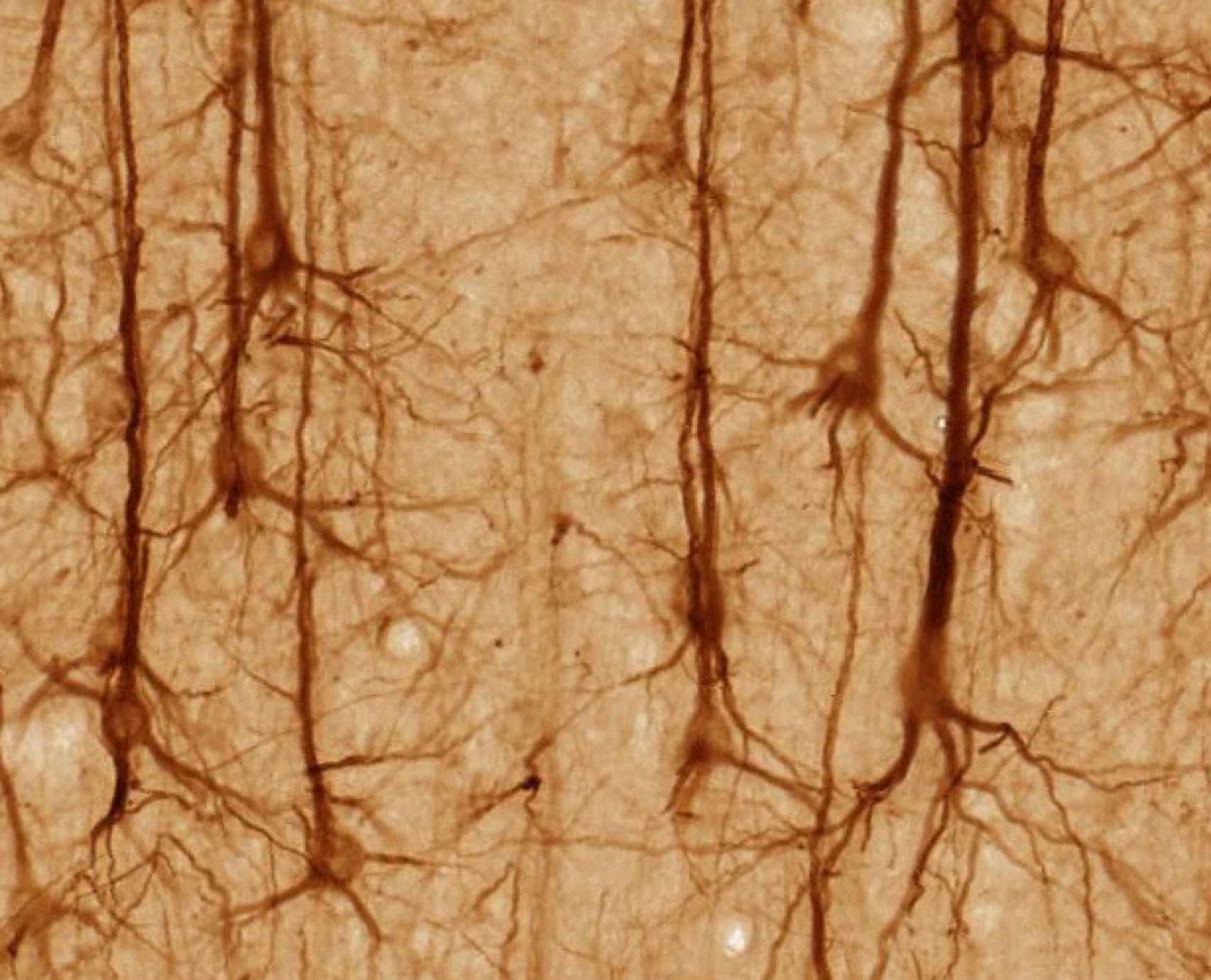 Neuronas del córtex cerebral