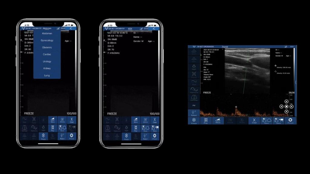 EagleView en pantallas de móviles y tablet