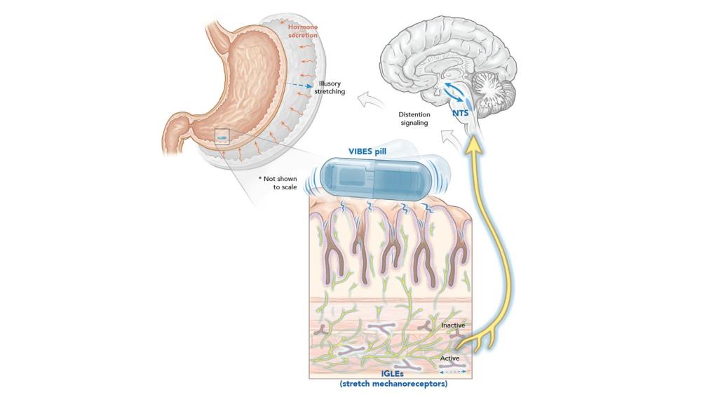 Funcionamiento de la píldora robótica VIBES