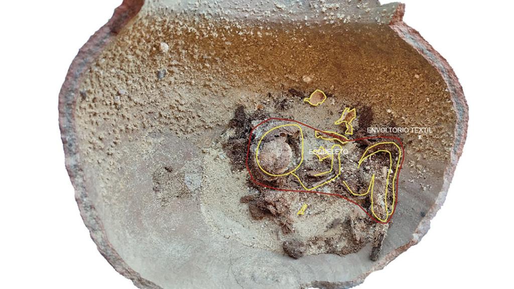 Inhumación fetal con la reconstrucción de la posición del cuerpo y el tejido.