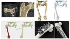 Una recreación de un implante óseo impreso en 3D extraído de uno de los casos clínicos del Hospital Gregorio Marañón.