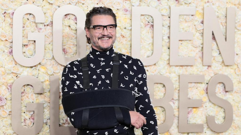 El actor Pedro Pascal posando ante los medios, muy sonriente con el brazo en cabestrillo.