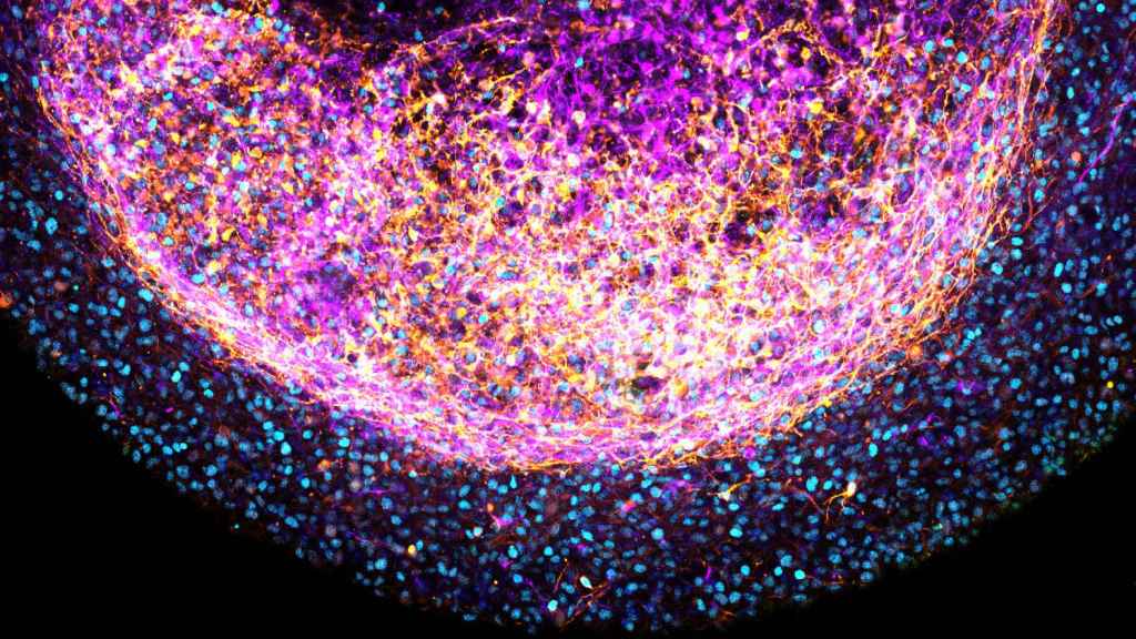 Primer plano de los organoides cerebrales creados a partir de células madre. Artegiani, Hendriks, Clevers