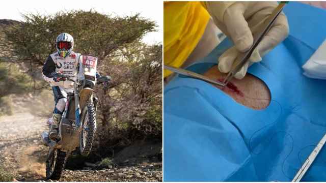 Javi Vega y su herida en el Rally Dakar 2024