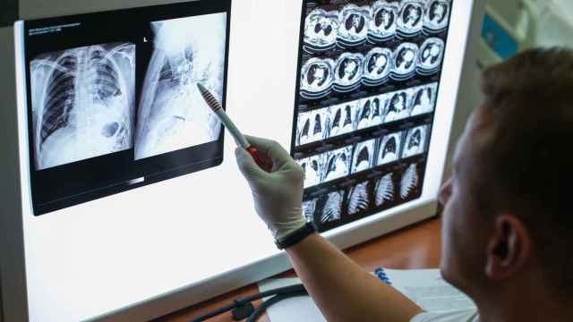 Diagnóstico de cáncer de pulmón con rayos X