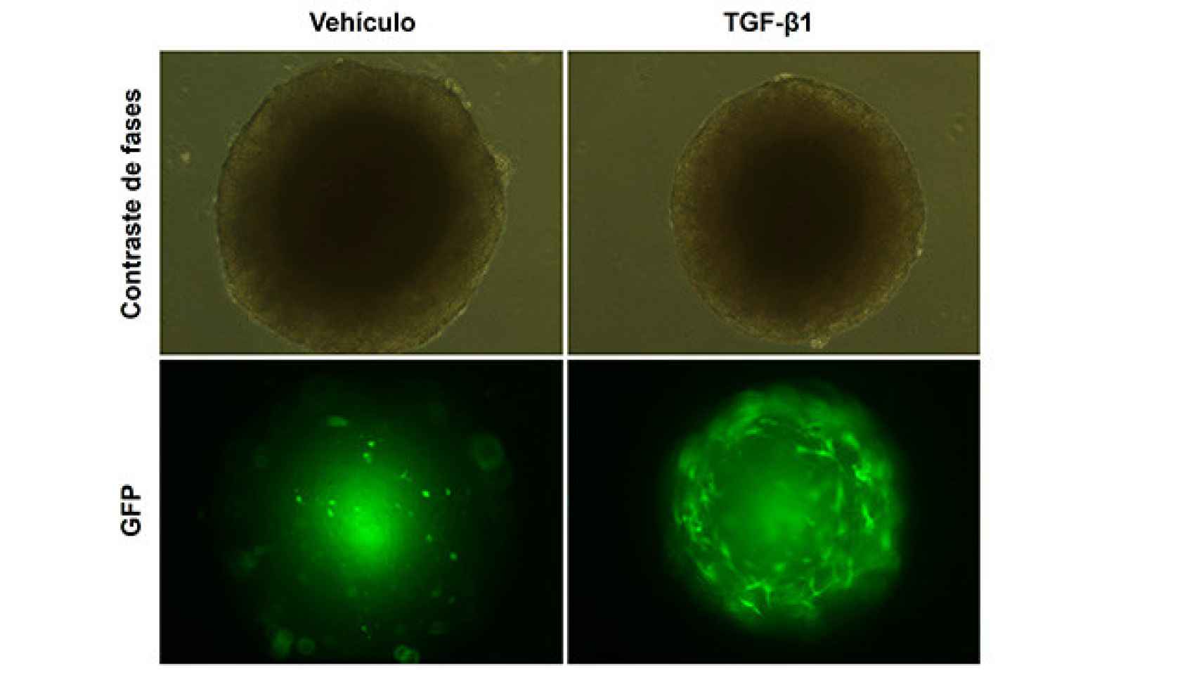 Imagen de esferoides mixtos formados por células tumorales y células hepáticas estrelladas marcadas con GFP tras el tratamiento con TGF-beta1 o el vehículo