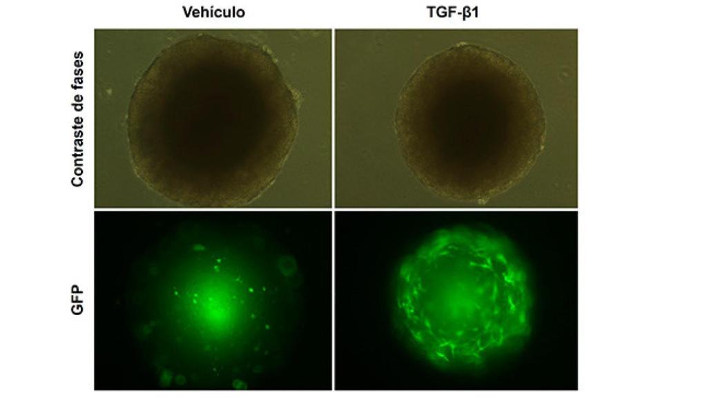 Imagen de esferoides mixtos formados por células tumorales y células hepáticas estrelladas marcadas con GFP tras el tratamiento con TGF-beta1 o el vehículo