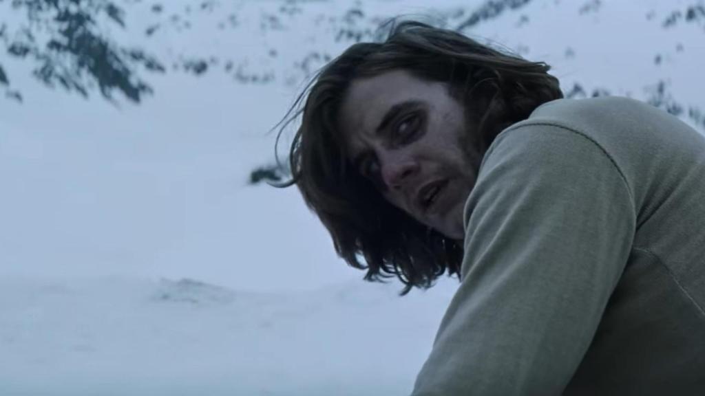 El 'signo del mapache' es común después de fracturas en la base del cráneo.