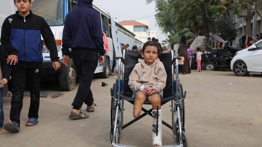 Un niño gazatí con una pierna amputada tras un ataque de Israel en la Franja.